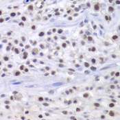 HAT1 Antibody - Immunohistochemistry of paraffin-embedded mouse cancer tissue.