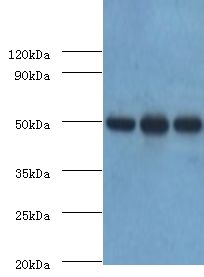 HAT1 Antibody - Western blot. All lanes: Histone acetyltransferase type B catalytic subunit antibody at 3 ug/ml. Lane 1: MCF-7 whole cell lysate. Lane 2: HepG2 whole cell lysate. Lane 3: 293T whole cell lysate. secondary Goat polyclonal to rabbit at 1:10000 dilution. Predicted band size: 50 kDa. Observed band size: 50 kDa.