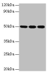 HAT1 Antibody - Western blot All lanes: HAT1 antibody at 3µg/ml Lane 1: MCF-7 whole cell lysate Lane 2: 293T whole cell lysate Lane 3: HepG2 whole cell lysate Secondary Goat polyclonal to rabbit IgG at 1/10000 dilution Predicted band size: 50, 40 kDa Observed band size: 50 kDa