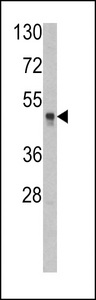 HAT1 Antibody - Western blot of KAT1 (HAT1) Antibody in HL60 cell line lysates (35 ug/lane). HAT1 (arrow) was detected using the purified antibody.