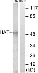 HAT1 Antibody - Western blot analysis of lysates from K562 cells, using HAT Antibody. The lane on the right is blocked with the synthesized peptide.