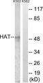 HAT1 Antibody - Western blot analysis of lysates from K562 cells, using HAT Antibody. The lane on the right is blocked with the synthesized peptide.