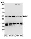 HAT1 Antibody - Detection of human and mouse HAT1 by western blot. Samples: Whole cell lysate (15 µg) from HeLa, HEK293T, Jurkat, mouse TCMK-1, and mouse NIH 3T3 cells prepared using NETN lysis buffer. Antibody: Affinity purified rabbit anti-HAT1 antibody used for WB at 0.1 µg/ml. Detection: Chemiluminescence with an exposure time of 10 seconds.