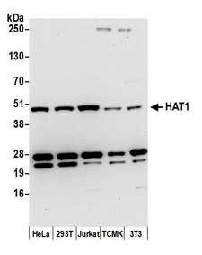 HAT1 Antibody - Detection of human and mouse HAT1 by western blot. Samples: Whole cell lysate (15 µg) from HeLa, HEK293T, Jurkat, mouse TCMK-1, and mouse NIH 3T3 cells prepared using NETN lysis buffer. Antibody: Affinity purified rabbit anti-HAT1 antibody used for WB at 0.1 µg/ml. Detection: Chemiluminescence with an exposure time of 10 seconds.