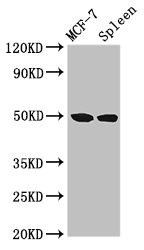 HAT1 Antibody - Western Blot Positive WB detected in:MCF-7 whole cell lysate,Rat spleen tissue All Lanes:HAT1 antibody at 3µg/ml Secondary Goat polyclonal to rabbit IgG at 1/50000 dilution Predicted band size: 50,40 KDa Observed band size: 50 KDa