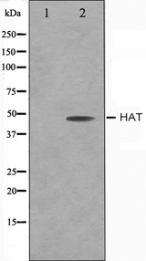 HAT1 Antibody - Western blot analysis on LOVO cells cell lysates using HAT antibody. The lane on the left is treated with the antigen-specific peptide.