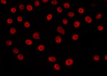 HAT1 Antibody - Staining LOVO cells by IF/ICC. The samples were fixed with PFA and permeabilized in 0.1% Triton X-100, then blocked in 10% serum for 45 min at 25°C. The primary antibody was diluted at 1:200 and incubated with the sample for 1 hour at 37°C. An Alexa Fluor 594 conjugated goat anti-rabbit IgG (H+L) Ab, diluted at 1/600, was used as the secondary antibody.