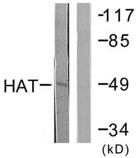 HAT1 Antibody - Western blot analysis of extracts from LOVO cells, using HAT antibody.
