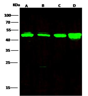 HAT1 Antibody - Anti-HAT1 rabbit polyclonal antibody at 1:500 dilution. Lane A: Jurkat Whole Cell Lysate. Lane B: K562 Whole Cell Lysate. Lane C: HepG2 Whole Cell Lysate. Lane D: U87MG Whole Cell Lysate. Lysates/proteins at 30 ug per lane. Secondary: Goat Anti-Rabbit IgG H&L (Dylight800) at 1/10000 dilution. Developed using the Odyssey technique. Performed under reducing conditions. Predicted band size: 49 kDa. Observed band size: 49 kDa.