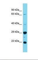 HAUS2 Antibody - Western blot of Human 721_B. HAUS2 antibody dilution 1.0 ug/ml.  This image was taken for the unconjugated form of this product. Other forms have not been tested.