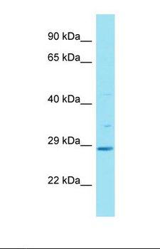 HAUS2 Antibody - Western blot of Human Fetal Liver. HAUS2 antibody dilution 1.0 ug/ml.  This image was taken for the unconjugated form of this product. Other forms have not been tested.
