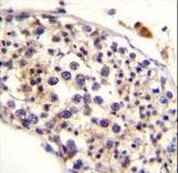 HAUS3 / C4orf15 Antibody - HAUS3 Antibody immunohistochemistry of formalin-fixed and paraffin-embedded human testis tissue followed by peroxidase-conjugated secondary antibody and DAB staining.