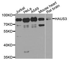 HAUS3 / C4orf15 Antibody - Western blot analysis of extract of various cells.