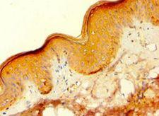 HAUS4 Antibody - Immunohistochemistry of paraffin-embedded human skin tissue using antibody at 1:100 dilution.