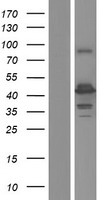 HAUS4 Protein - Western validation with an anti-DDK antibody * L: Control HEK293 lysate R: Over-expression lysate