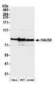 HAUS5 Antibody - Detection of human HAUS5 by western blot. Samples: Whole cell lysate (50 µg) from HeLa, HEK293T, and Jurkat cells prepared using NETN lysis buffer. Antibody: Affinity purified rabbit anti-HAUS5 antibody used for WB at 1:1000. Detection: Chemiluminescence with an exposure time of 3 seconds.