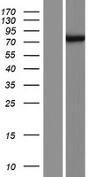 HAUS5 Protein - Western validation with an anti-DDK antibody * L: Control HEK293 lysate R: Over-expression lysate
