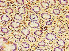 HAUS6 / FAM29A Antibody - Immunohistochemistry of paraffin-embedded human small intestine using antibody at 1:100 dilution.