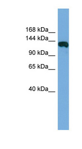 HAUS6 / FAM29A Antibody - HAUS6 / FAM29A antibody Western blot of Fetal Muscle lysate. This image was taken for the unconjugated form of this product. Other forms have not been tested.