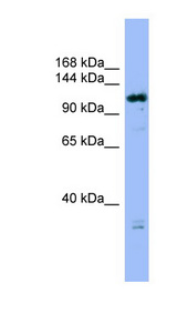 HAUS6 / FAM29A Antibody - HAUS6 / FAM29A antibody Western blot of MCF7 cell lysate. This image was taken for the unconjugated form of this product. Other forms have not been tested.