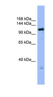 HAUS6 / FAM29A Antibody - HAUS6 / FAM29A antibody Western blot of MCF7 cell lysate. This image was taken for the unconjugated form of this product. Other forms have not been tested.