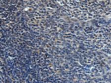 HAUS6 / FAM29A Antibody - Immunohistochemistry of paraffin-embedded Human tonsil tissue  using HAUS6 Polyclonal Antibody at dilution of 1:45(×200)