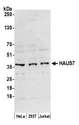 HAUS7 Antibody - Detection of human HAUS7 by western blot. Samples: Whole cell lysate (50 µg) from HeLa, HEK293T, and Jurkat cells prepared using NETN lysis buffer. Antibody: Affinity purified rabbit anti-HAUS7 antibody used for WB at 0.1 µg/ml. Detection: Chemiluminescence with an exposure time of 3 minutes.