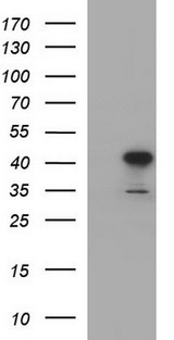 HAUS7 Antibody - HEK293T cells were transfected with the pCMV6-ENTRY control (Left lane) or pCMV6-ENTRY HAUS7 (Right lane) cDNA for 48 hrs and lysed. Equivalent amounts of cell lysates (5 ug per lane) were separated by SDS-PAGE and immunoblotted with anti-HAUS7.