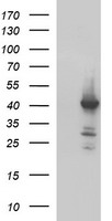 HAUS7 Antibody - HEK293T cells were transfected with the pCMV6-ENTRY control (Left lane) or pCMV6-ENTRY HAUS7 (Right lane) cDNA for 48 hrs and lysed. Equivalent amounts of cell lysates (5 ug per lane) were separated by SDS-PAGE and immunoblotted with anti-HAUS7.