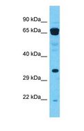 HAUS7 Antibody - Western blot of HAUS7 Antibody with human Thymus Tumor lysate.  This image was taken for the unconjugated form of this product. Other forms have not been tested.