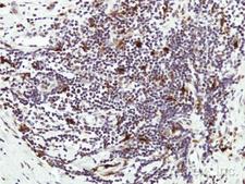 HAUS8 Antibody - IHC of paraffin-embedded Human lymph tissue using HAUS8 antibody at 1:50 dilution.