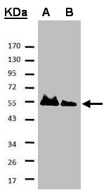 HAUS8 Antibody - Sample. A: His-Hice1 (2x), B: His-Hice1 (1x). 7.5% SDS PAGE. HAUS8 antibody diluted at 1:500