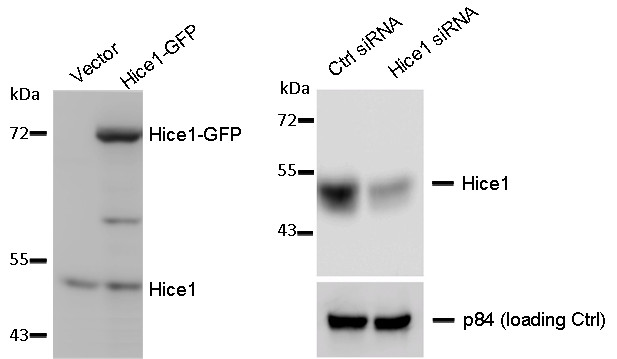 HAUS8 Antibody - WB to detect cellular Hice1 and Hice1-GFP expressed in human osteosarcoma U2OS cells (left image) , and Hice1 upon siRNA treatment (right image) using HAUS8 antibody at 1:1000 dilution. Nuclear matrix protein p84 is a loading control, blotted with p84 antibody (clone 5E10) GTX70220 at 1:5000 dilution.