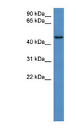 HAUS8 Antibody - HAUS8 antibody Western blot of HeLa lysate.  This image was taken for the unconjugated form of this product. Other forms have not been tested.