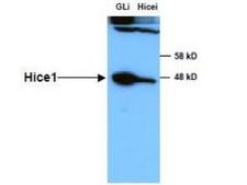 HAUS8 Antibody - Anti-HICE1 in Western blot of Immunochemicals' Anti-HICE1 Antibody shows detection of a 45 kDa band corresponding to endogenous HICE1 in lysates of S phase HeLa cells silenced for either control Luciferase or HICE1. In right lane (HICE1i): lysates from sh-HICE1 RNAi-treated lentivirus-infected cells. In left lane (GLi): lysates from sh-Luciferase lentivirus-infected cells as control. Anti-HICE1 Antibody was used at 1:10000. Molecular weight estimation was made by comparison by prestained MW markers. ECL was used for detection. Personal communication, Kyung S. Lee, NCI, Bethesda, MD.