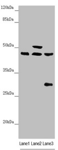 HAUS8 Antibody - Western blot All Lanes:HAUS8 antibody at 2.35 ug/ml Lane 1: Mouse kidney tissue Lane 2: Mouse brain tissue Lane 3: A549 whole cell lysate Secondary Goat polyclonal to rabbit IgG at 1/10000 dilution Predicted band size: 45,39 kDa Observed band size: 45,50,28 kDa