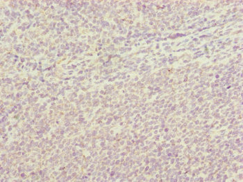 HAUS8 Antibody - Immunohistochemistry of paraffin-embedded human tonsil tissue at dilution of 1:100