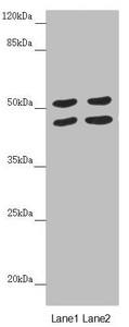 HAUS8 Antibody - Western blot All Lanes:HAUS8 antibody at 5.18 ug/ml Lane 1: Hela whole cell lysate Lane 2: A549 whole cell lysate Secondary Goat polyclonal to rabbit IgG at 1/10000 dilution Predicted band size: 45,39 kDa Observed band size: 45,52 kDa