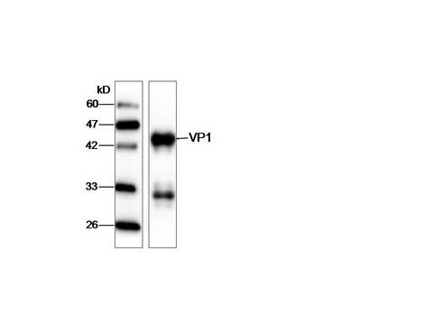 HAV VP1 Antibody - Western blot against recombinant HAC VP1 protein