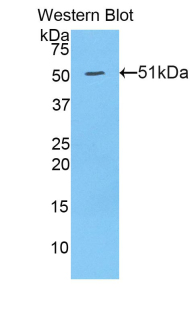 HAVCR1 / KIM-1 Antibody - Western blot of recombinant HAVCR1 / KIM-1.  This image was taken for the unconjugated form of this product. Other forms have not been tested.