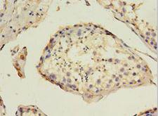 HAVCR1 / KIM-1 Antibody - Immunohistochemistry of paraffin-embedded human testis tissue using antibody at 1:100 dilution.  This image was taken for the unconjugated form of this product. Other forms have not been tested.