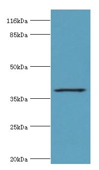 HAVCR1 / KIM-1 Antibody - Western blot. All lanes: HAVCR1 antibody at 2 ug/ml+mouse brain tissue. Secondary antibody: goat polyclonal to rabbit at 1:10000 dilution. Predicted band size: 39 kDa. Observed band size: 39 kDa.  This image was taken for the unconjugated form of this product. Other forms have not been tested.