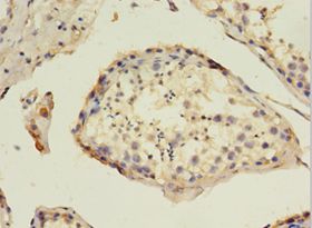 HAVCR1 / KIM-1 Antibody - Immunohistochemistry of paraffin-embedded human testis tissue using antibody at 1:100 dilution.  This image was taken for the unconjugated form of this product. Other forms have not been tested.