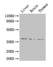HAVCR1 / KIM-1 Antibody - Western Blot Positive WB detected in: Mouse liver, Mouse brain, Mouse thymus All lanes: HAVCR1 antibody at 4µg/ml Secondary Goat polyclonal to rabbit IgG at 1/50000 dilution Predicted band size: 33 kDa Observed band size: 39 kDa