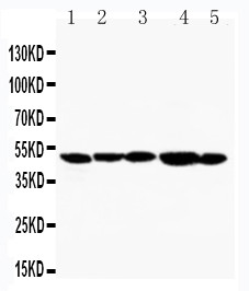 HAVCR1 / KIM-1 Antibody - WB of HAVCR1 / KIM-1 antibody. Lane 1: SMMC Cell Lysate. Lane 2: HELA Cell Lysate. Lane 3: PANC Cell Lysate. Lane 4: M231 Cell Lysate. Lane 5: M453 Cell Lysate.