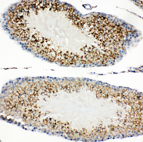 HAVCR1 / KIM-1 Antibody - HAVCR1 / KIM-1 antibody. IHC(P): Rat Testis Tissue.