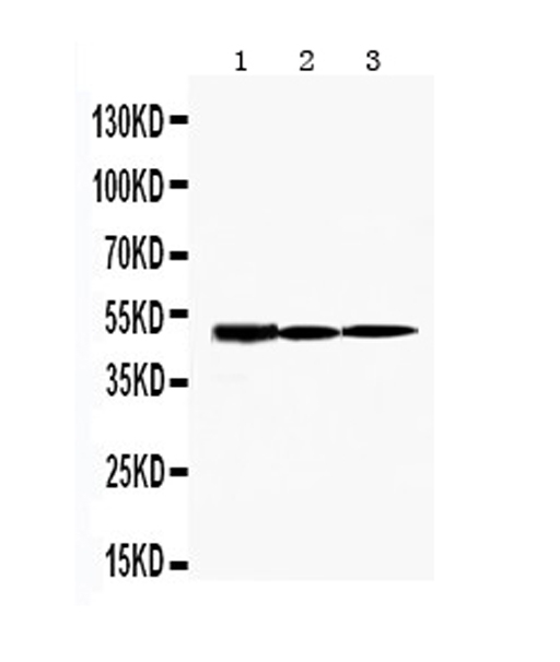 HAVCR1 / KIM-1 Antibody - Western blot analysis of KIM1 using anti-KIM1 antibody. Electrophoresis was performed on a 5-20% SDS-PAGE gel at 70V (Stacking gel) / 90V (Resolving gel) for 2-3 hours. The sample well of each lane was loaded with 50ug of sample under reducing conditions. Lane 1: rat kidney tissue lysates, Lane 2: rat testis tissue lysates, Lane 3: rat heart tissue lysates. After Electrophoresis, proteins were transferred to a Nitrocellulose membrane at 150mA for 50-90 minutes. Blocked the membrane with 5% Non-fat Milk/ TBS for 1.5 hour at RT. The membrane was incubated with rabbit anti-KIM1 antigen affinity purified polyclonal antibody at 0.5 µg/mL overnight at 4°C, then washed with TBS-0.1% Tween 3 times with 5 minutes each and probed with a goat anti-rabbit IgG-HRP secondary antibody at a dilution of 1:10000 for 1.5 hour at RT. The signal is developed using an Enhanced Chemiluminescent detection (ECL) kit with Tanon 5200 system. A specific band was detected for KIM1 at approximately 50KD. The expected band size for KIM1 is at 39KD.