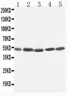 HAVCR1 / KIM-1 Antibody - WB of HAVCR1 / KIM-1 antibody. All lanes: Anti-HAVCR1 at 0.5ug/ml. Lane 1: SMMC Whole Cell Lysate at 40ug. Lane 2: HELA Whole Cell Lysate at 40ug. Lane 3: PANC Whole Cell Lysate at 40ug. Lane 4: M231 Whole Cell Lysate at 40ug. Lane 5: M453 Whole Cell Lysate at 40ug. Predicted bind size: 39KD. Observed bind size: 50KD.