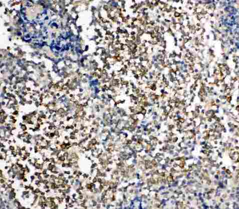 HAVCR1 / KIM-1 Antibody - Anti-TIM 1 antibody, IHC(P): Human Tonsil Tissue