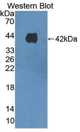 HAVCR1 / KIM-1 Antibody - Western blot of HAVCR1 / KIM-1 antibody.